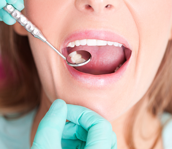 Dentist checking patient's metal free dental restorations