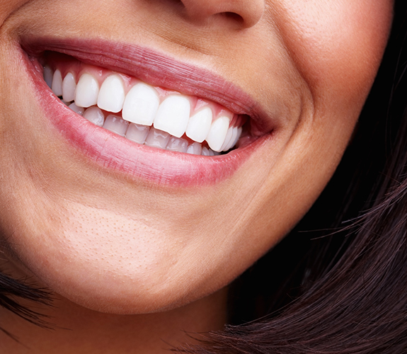 Closeup of healthy smile after gum recontouring