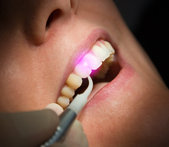 Patient receiving soft tissue laser dentistry treatment