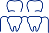 Animated dental implant supported denture