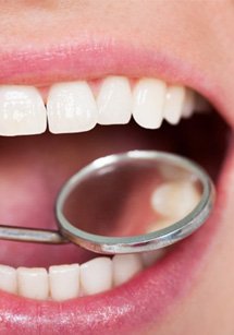 Close up of patient opening their mouth for dental mirror