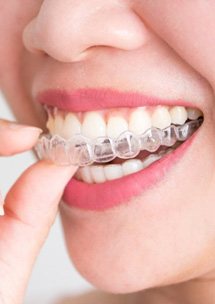 Patient inserting a clear aligner tray