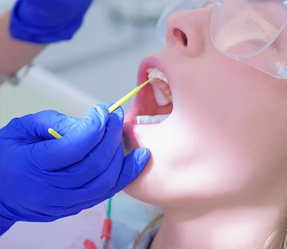 Young patient receiving fluoride treatment