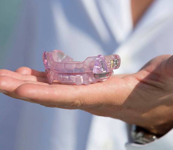 Hand holding a custom sleep apnea oral appliance