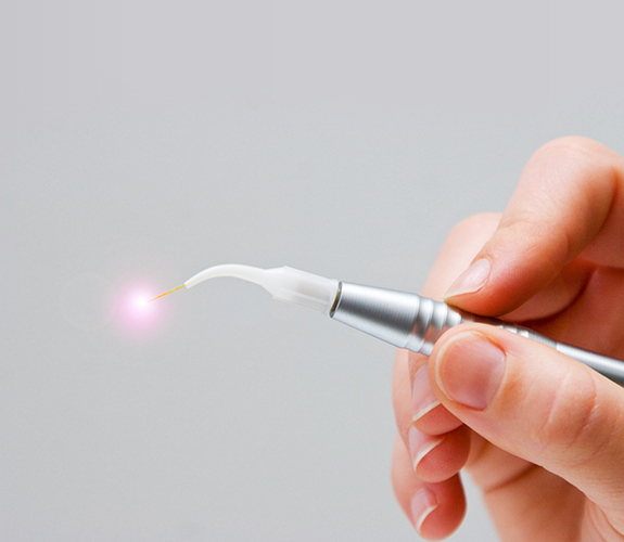 Hand holding soft tissue laser dentistry hand tool