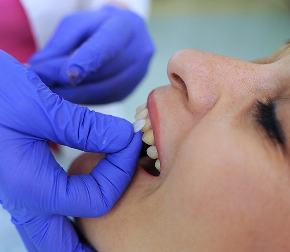 Patient preparing for veneers in Wilmington